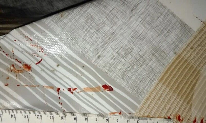 На Рівненщині чоловік відрубав знайомому пальці, підозрюючи його у крадіжці