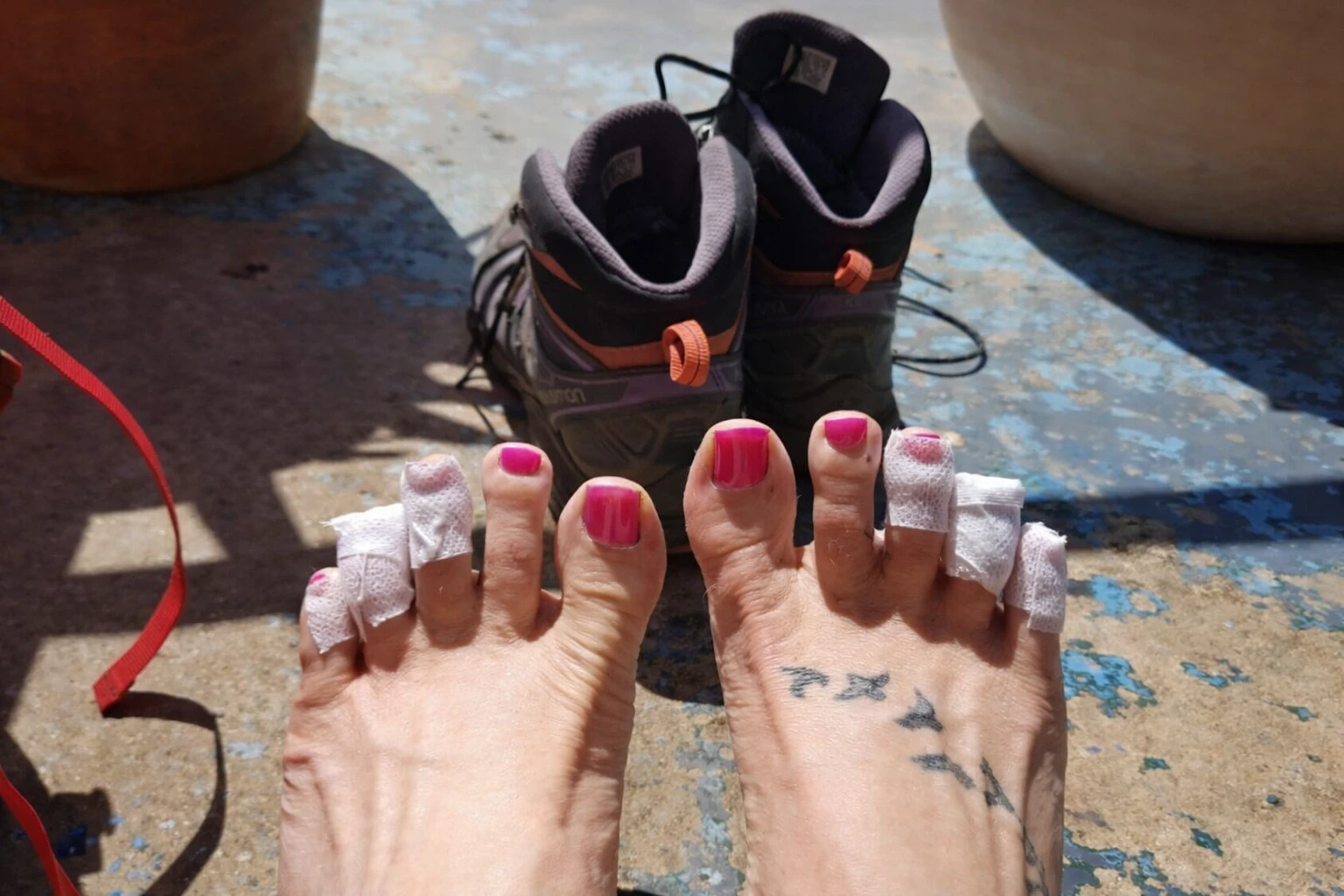 Як лікувати мокрі мозолі на ногах у домашніх умовах